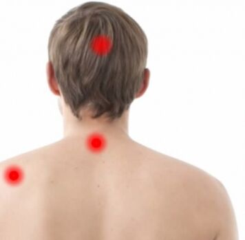 Osteochondrose -Herde