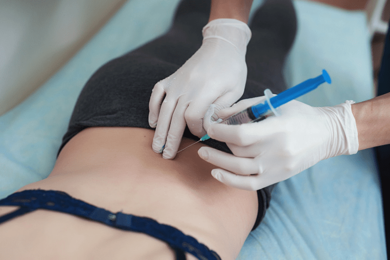 Blockade bei lumbaler Osteochondrose